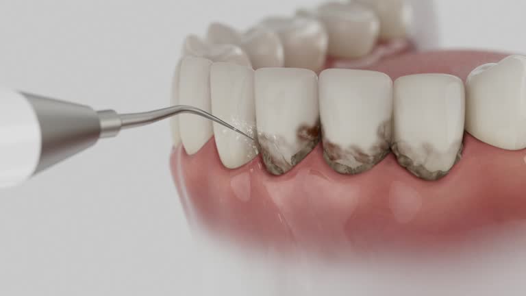 Trusted Dental Crowns And Bridges service in Wallace, ID - Dentist Open Now